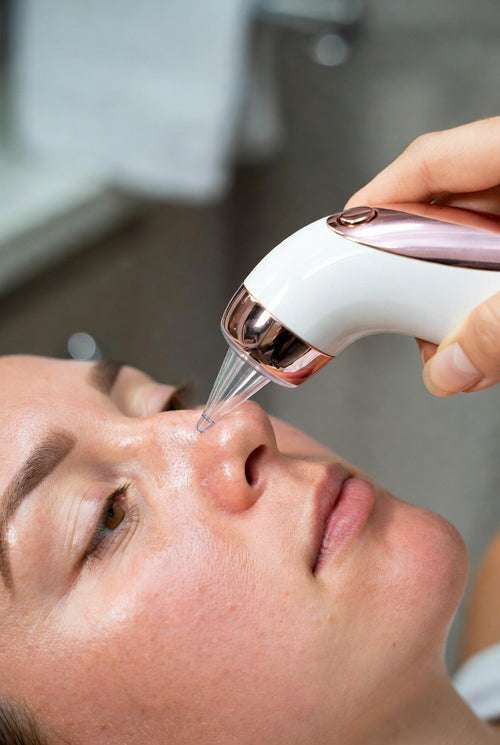 Aspirateur Points Noirs – Appareil Électrique Soin Visage Anti-Acné